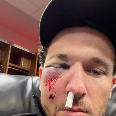 Bregman